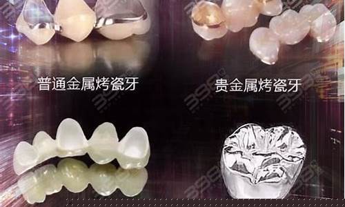 镶牙生物合金价格_镶牙生物合金价格贵吗