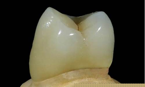 钯金合金烤瓷冠价格_钯银烤瓷合金价格